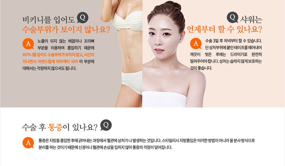 Q. 비키니를 입어도 수술부위가 보이지 않나요?
A. 노출이 되지 않는 배꼽이나 꼬리뼈 부분을 이용하여 흡입하기 때문에 비키니를 입어도 수술부위가 보이지 않고, 시간이 지나면서 자연스럽게 피부색이 되어 이 부분에 대해서는 걱정하지 않으셔도 됩니다.
Q. 샤워는 언제부터 할 수 있나요?
A. 수술 3일 후 저녁부터 할 수 있습니다. 단 상처부위에 붙인 테이프를 떼어내어 깨끗이 씻은 후에는 드라이기로 완전히 말려주어야 합니다. 상처는 습하지 않게 보호하는 것이 좋습니다.
Q. 수술 후 통증이 있나요?
A. 통증은 지방을 흡입한 후에 긁어내는 과정에서 혈관에 상처가 나 발생하는 것입니다. 스타일리시 지방흡입은 이러한 방법이 아니라 물 분사 방식으로 분리를 하는 것이기 때문에 신경이나 혈관에 손상을 입히지 않아 통증의 걱정이 덜어집니다.

