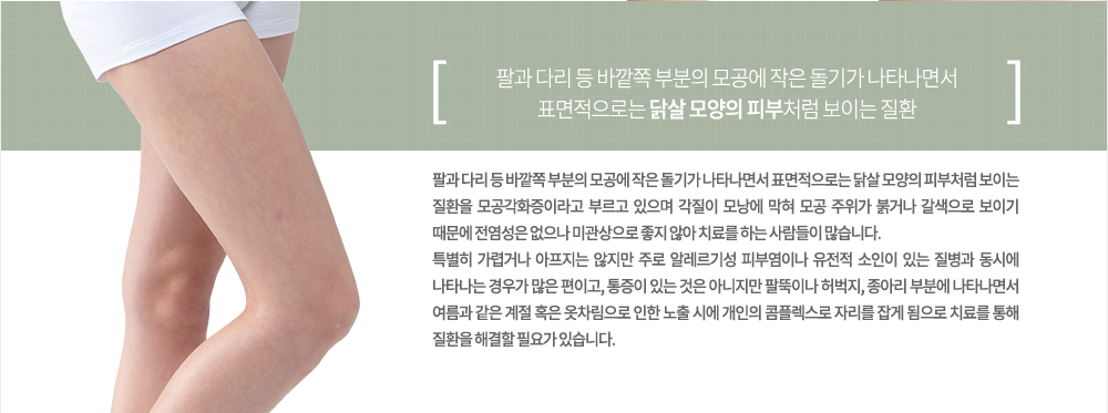 특징 및 원인
팔과 다리 등 바깥쪽 부분의 모공에 작은 돌기가 나타나면서 표면적으로는 닭살 모양의 피부처럼 보이는 질환을 모공각화증이라고 부르고 있으며 각질이 모낭에 막혀 모공 주위가 붉거나 갈색으로 보이기 때문에 전염성은 없으나 미관상으로 좋지 않아 치료를 하는 사람들이 많습니다.
특별히 가렵거나 아프지는 않지만 주로 알레르기성 피부염이나 유전적 소인이 있는 질병과 동시에 나타나는 경우가 많은 편이고, 통증이 있는 것은 아니지만 팔뚝이나 허벅지, 종아리 부분에 나타나면서 여름과 같은 계절 혹은 옷차림으로 인한 노출 시에 개인의 콤플렉스로 자리를 잡게 됨으로 치료를 통해 질환을 해결할 필요가 있습니다. 
