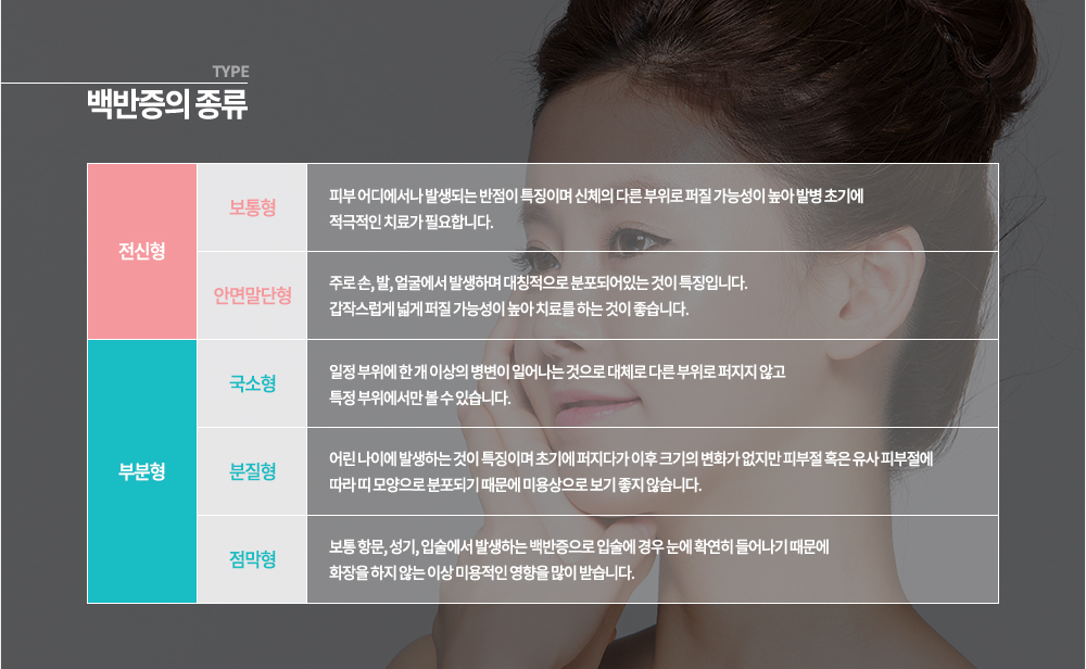 백반증의 종류 ▶ 전신형
- 보통형
피부 어디에서나 발생되는 반점이 특징이며 신체의 다른 부위로 퍼질 가능성이 높아 발병 초기에 적극적인 치료가 필요합니다.
- 안면말단형
주로 손, 발, 얼굴에서 발생하며 대칭적으로 분포되어있는 것이 특징입니다. 갑작스럽게 넓게 퍼질 가능성이 높아 치료를 하는 것이 좋습니다.
▶ 부분형
- 국소형
일정 부위에 한 개 이상의 병변이 일어나는 것으로 대체로 다른 부위로 퍼지지 않고 특정 부위에서만 볼 수 있습니다.
- 분질형
어린 나이에 발생하는 것이 특징이며 초기에 퍼지다가 이후 크기의 변화가 없지만 피부절 혹은 유사 피부절에 따라 띠 모양으로 분포되기 때문에 미용상으로 보기 좋지 않습니다.
- 점막형
보통 항문, 성기, 입술에서 발생하는 백반증으로 입술에 경우 눈에 확연히 들어나기 때문에 화장을 하지 않는 이상 미용적인 영향을 많이 받습니다.
