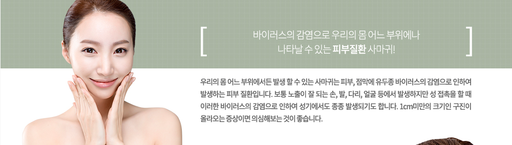 -특징
우리의 몸 어느 부위에서든 발생 할 수 있는 사마귀는 피부, 점막에 유두종 바이러스의 감염으로 인하여 발생하는 피부 질환입니다. 보통 노출이 잘 되는 손, 발, 다리, 얼굴 등에서 발생하지만 성 접촉을 할 때 이러한 바이러스의 감염으로 인하여 성기에서도 종종 발생되기도 합니다. 1cm미만의 크기인 구진이 올라오는 증상이면 의심해보는 것이 좋습니다.
