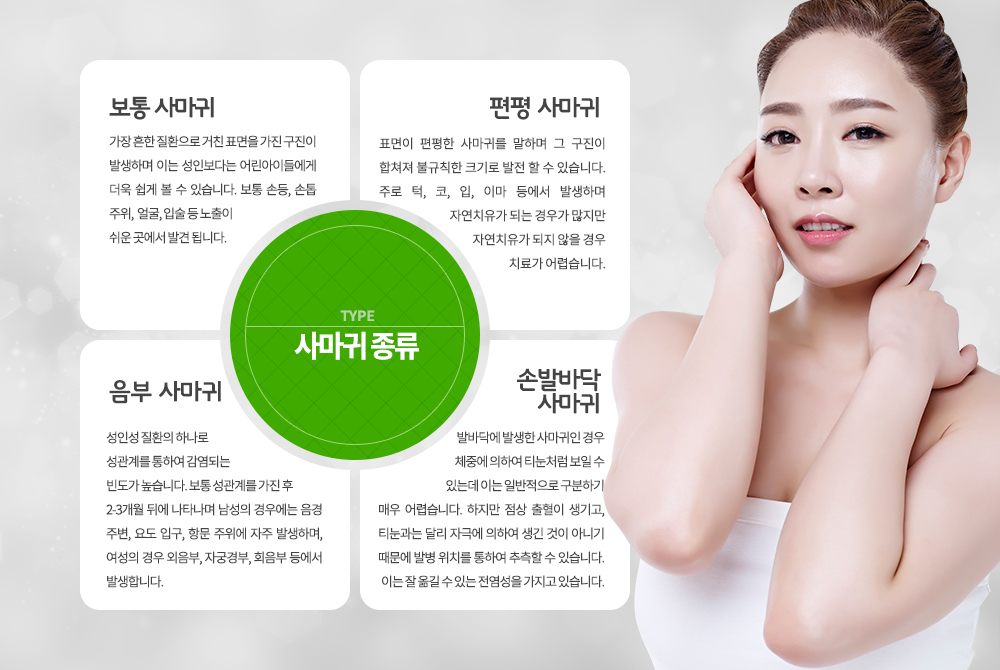 ▶ 보통 사마귀
가장 흔한 질환으로 거친 표면을 가진 구진이 발생하며 이는 성인보다는 어린아이들에게 더욱 쉽게 볼 수 있습니다. 보통 손등, 손톱 주위, 얼굴, 입술 등 노출이 쉬운 곳에서 발견 됩니다.

▶ 편평 사마귀
표면인 편평한 사마귀를 말하며 그 구진이 합쳐져 불규칙한 크기로 발전 할 수 있습니다. 주로 턱, 코, 입, 이마 등에서 발생하며 자연치유가 되는 경우가 많지만 자연치유가 되지 않을 경우 치료가 어렵습니다.

▶ 손발바닥 사마귀
발바닥에 방생한 사마귀인 경우 체중에 의하여 티눈처럼 보일 수 있는데 이는 일반적으로 구분하기 매우 어렵습니다. 하지만 점상 출혈이 생기고, 티눈과는 달리 자극에 의하여 생긴 것이 아니기 때문에 발병 위치를 통하여 추측할 수 있습니다. 이는 잘 옮길 수 있는 전염성을 가지고 있습니다.

▶ 음부 사마귀 (뾰족콘딜로마)
성인성 질환의 하나로 성관계를 통하여 감염되는 빈도가 높습니다. 보통 성관계를 가진 후 2-3개월 뒤에 나타나며 남성의 경우에는 음경 주변, 요도 입구, 항문 주위에 자주 발생하며, 여성의 경우 외음부, 자궁경부, 회음부 등에서 발생합니다.
