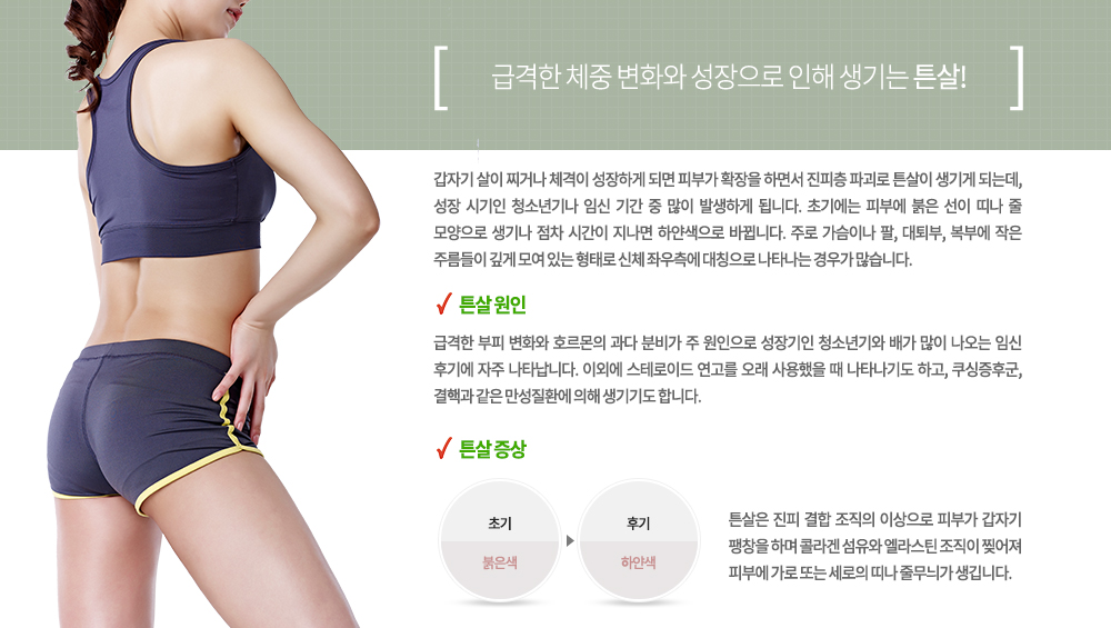 갑자기 살이 찌거나 체격이 성장하게 되면 피부가 확장을 하면서 진피층 파괴로 튼살이 생기게 되는데, 성장 시기인 청소년기나 임신 기간 중 많이 발생하게 됩니다. 초기에는 피부에 붉은 선이 띠나 줄 모양으로 생기나 점차 시간이 지나면 하얀색으로 바뀝니다. 주로 가슴이나 팔, 대퇴부, 복부에 작은 주름들이 깊게 모여 있는 형태로 신체 좌우측에 대칭으로 나타나는 경우가 많습니다.♧튼살 원인
급격한 부피 변화와 호르몬의 과다 분비가 주 원인으로 성장기인 청소년기와 배가 많이 나오는 임신 후기에 자주 나타납니다. 이외에 스테로이드 연고를 오래 사용했을 때 나타나기도 하고, 쿠싱증후군, 결핵과 같은 만성질환에 의해 생기기도 합니다.

♧튼살 증상
튼살은 진피 결합 조직의 이상으로 피부가 갑자기 팽창을 하며 콜라겐 섬유와 엘라스틴 조직이 찢어져 피부에 가로 또는 세로의 띠나 줄무늬가 생깁니다.
초기 : 붉은색 -> 후기 : 하얀색
