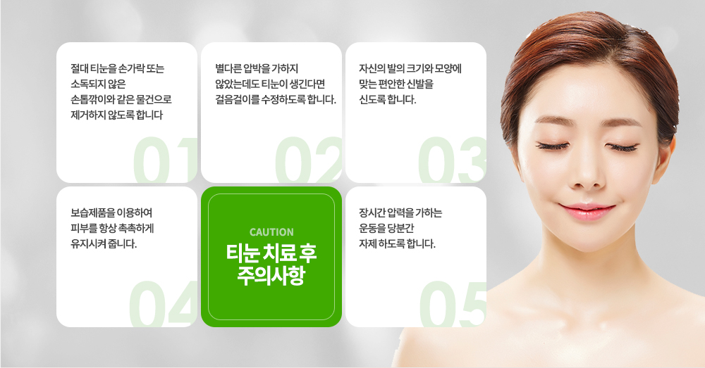 -티눈 치료 후 주의사항
① 절대 티눈을 손가락 또는 소독되지 않은 손톱깎이와 같은 물건으로 제거하지 않도록 합니다.
② 별다른 압박을 가하지 않았는데도 티눈이 생긴다면 걸음걸이를 수정하도록 합니다.
③ 자신의 발의 크기와 모양에 맞는 편안한 신발을 신도록 합니다.
④ 보습제품을 이용하여 피부를 항상 촉촉하게 유지시켜 줍니다.
⑤ 장시간 압력을 가하는 운동을 당분간 자제 하도록 합니다.
