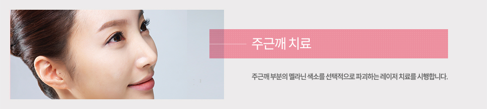 치료
주근깨 부분의 멜라닌 색소를 선택적으로 파괴하는 레이저 치료를 시행합니다.

