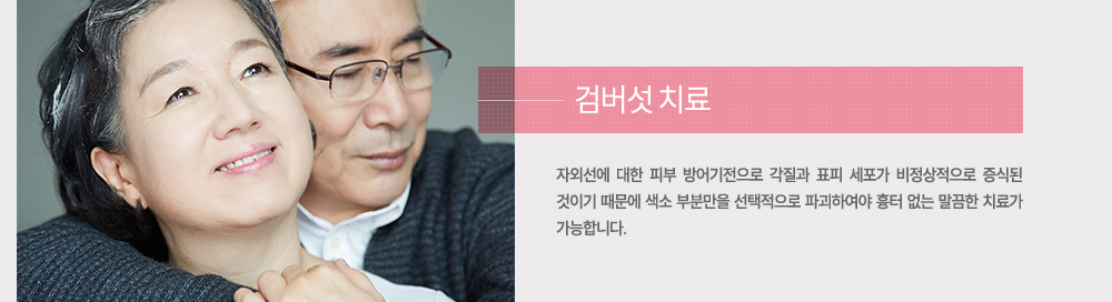 치료
자외선에 대한 피부 방어기전으로 각질과 표피 세포가 비정상적으로 증식된 것이기 때문에 색소 부분만을 선택적으로 파괴하여야 흉터 없는 말끔한 치료가 가능합니다.
