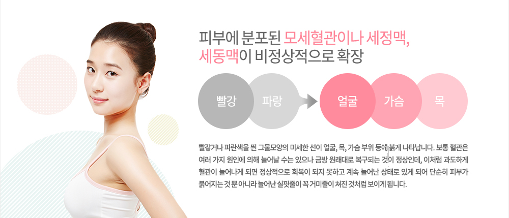 특징
피부에 분포된 모세혈관이나 세정맥, 세동맥이 비정상적으로 확장되어 빨갛거나 파란색을 띈 그물모양의 미세한 선이 얼굴, 목, 가슴 부위 등에 붉게 나타납니다. 보통 혈관은 여러 가지 원인에 의해 늘어날 수는 있으나 금방 원래대로 복구되는 것이 정상인데, 이처럼 과도하게 혈관이 늘어나게 되면 정상적으로 회복이 되지 못하고 계속 늘어난 상태로 있게 되어 단순히 피부가 붉어지는 것 뿐 아니라 늘어난 실핏줄이 꼭 거미줄이 쳐진 것처럼 보이게 됩니다.
