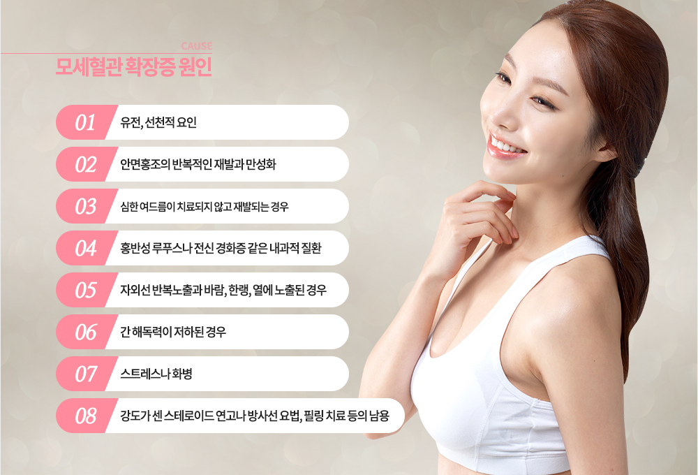 -모세혈관 확장증 발생 원인
유전, 선천적 요인
안면홍조의 반복적인 재발과 만성화
심한 여드름이 치료되지 않고 재발되는 경우
홍반성 루푸스나 전신 경화증 같은 내과적 질환
자외선 반복노출과 바람, 한랭, 열에 노출된 경우
간 해독력이 저하된 경우
강도가 센 스테로이드 연고나 방사선 요법, 필링 치료 등의 남용
스트레스나 화병
