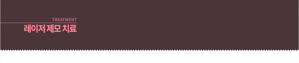-레이저 제모 치료 
